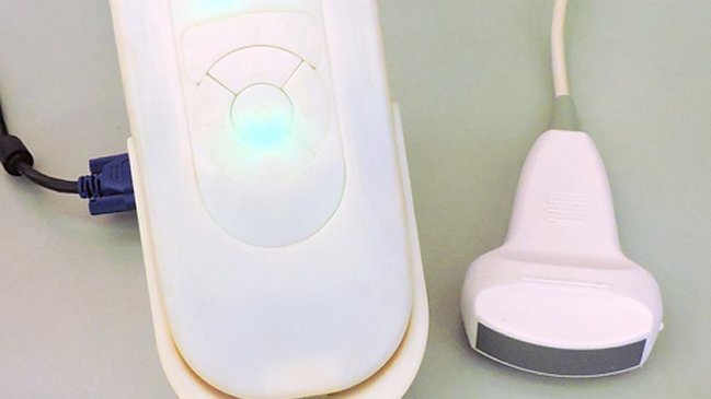 Inventores chilenos crean un ecógrafo portátil para médicos de zonas aisladas
