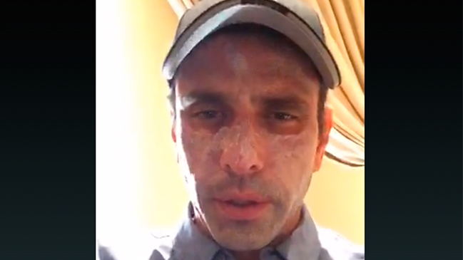 Henrique Capriles reveló graves lesiones en la piel