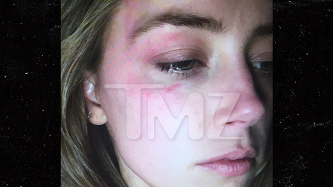 Amber Heard acusa violencia doméstica por parte de Johnny Depp