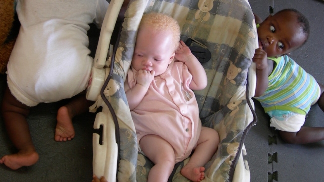 Malaui prohíbe la brujería para tratar de impedir los asesinatos de albinos