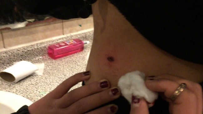 Dos secundarias fueron heridas con balines de goma durante marcha en Ñuñoa