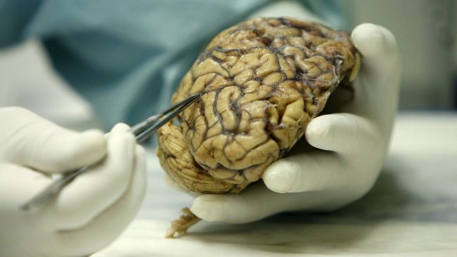 Joven fue detenido por drogarse usando cerebro humano con formol