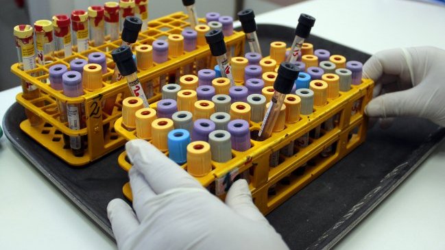 Confirman nuevo caso de virus hanta en la Región del Biobío