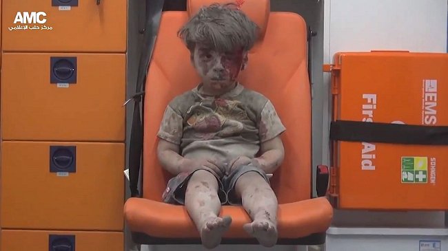 Imagen de niño herido en bombardeo vuelve a alertar sobre el drama sirio