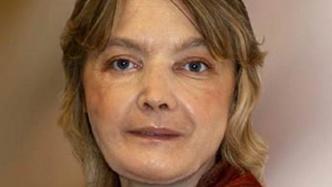 Murió la mujer francesa que recibió el primer trasplante mundial de cara