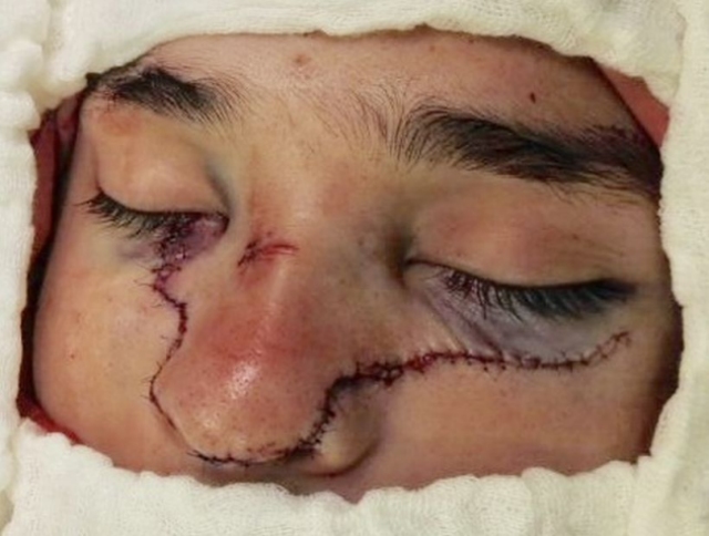 Imagen foto_00000002