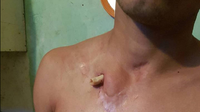 La impactante imagen de un preso que genera debate en Argentina