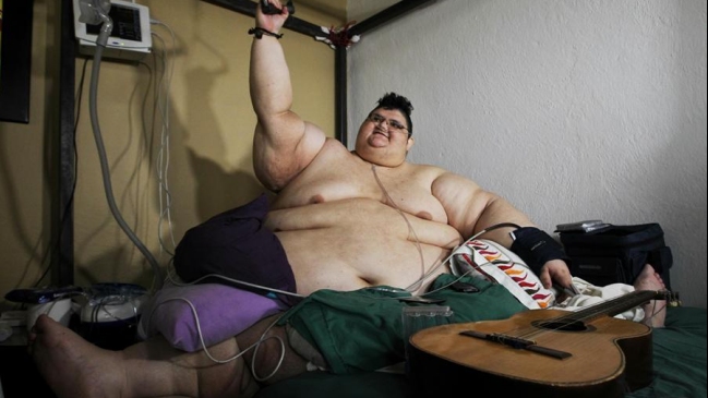 El hombre más obeso del mundo pesa 590 kilos, según reportó su médico
