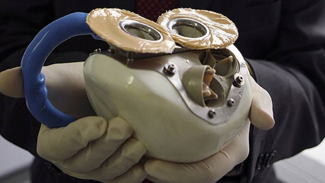 Francia suspendió los implantes de un corazón artificial tras la quinta muerte