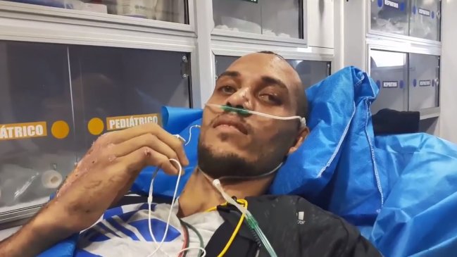 El defensa de Chapecoense Helio Neto podrá volver a entrenar en tres o cuatro meses