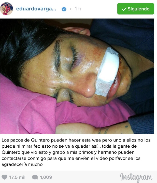 Imagen foto_00000015