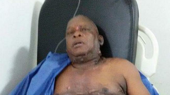 Alcalde en Colombia terminó con el 40 % de su cuerpo quemado tras pelea con su esposa