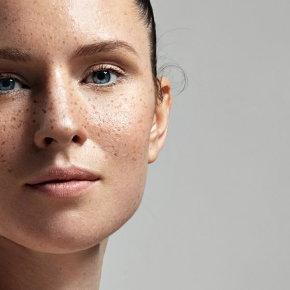 Tatuajes de pecas: la nueva tendencia en cosmética