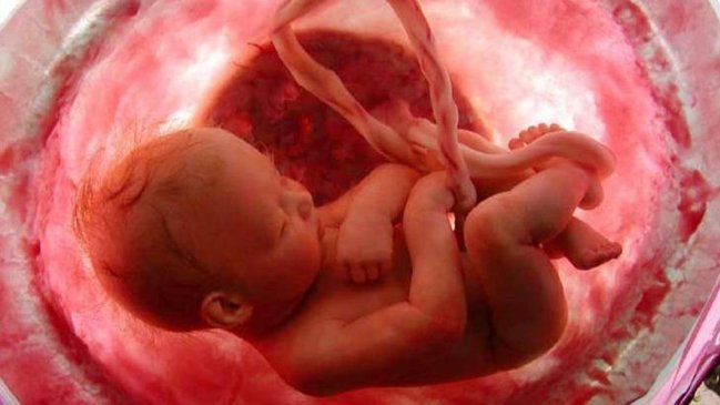 Hospital Sótero del Río acogió procedimiento pionero de cirugía fetal