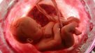 Hospital Sótero del Río acogió procedimiento pionero de cirugía fetal