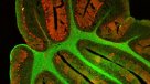 Identifican proteínas cuya supresión podría curar cánceres como la leucemia