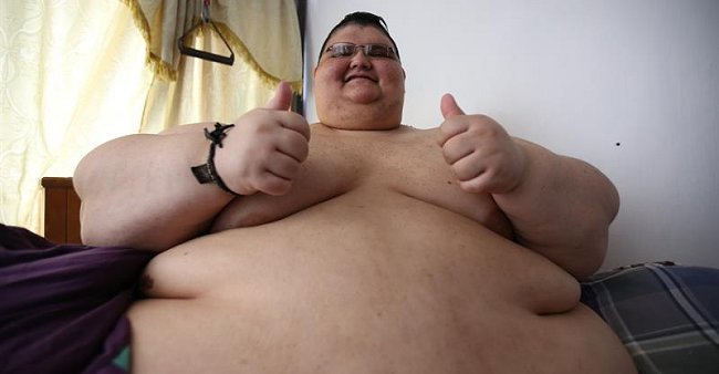 El hombre más obeso del mundo será operado tras bajar 175 kilos
