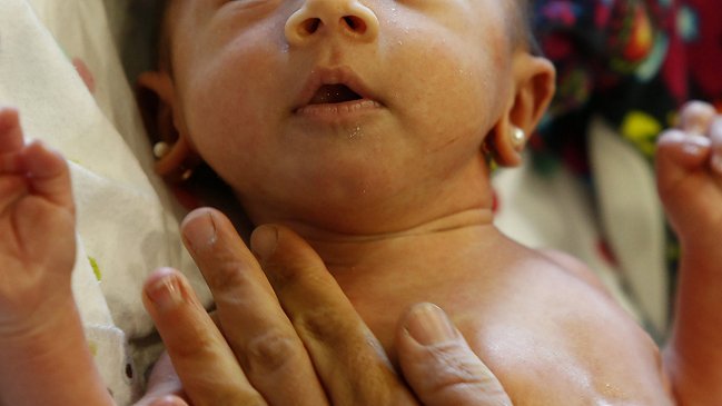 Fonasa: Examen de estreptococo B 