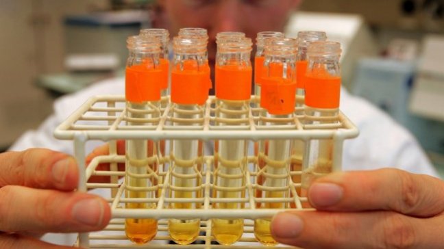 Científicos identificaron 40 nuevos genes relacionados con la inteligencia