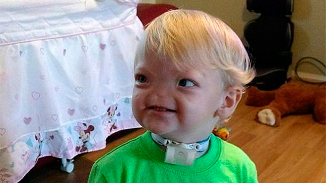 A los dos años murió el 