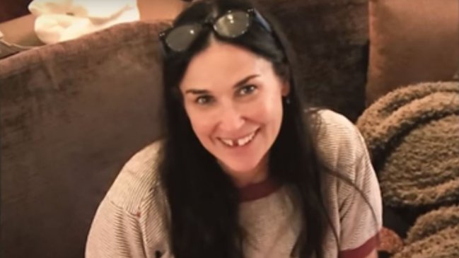 Demi Moore contó cómo se le cayeron dos dientes delanteros