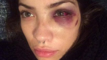 #NiUnaMenos convoca marcha bajo la consigna 