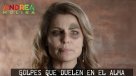Andrea Molina personifica a mujer golpeada en campaña \