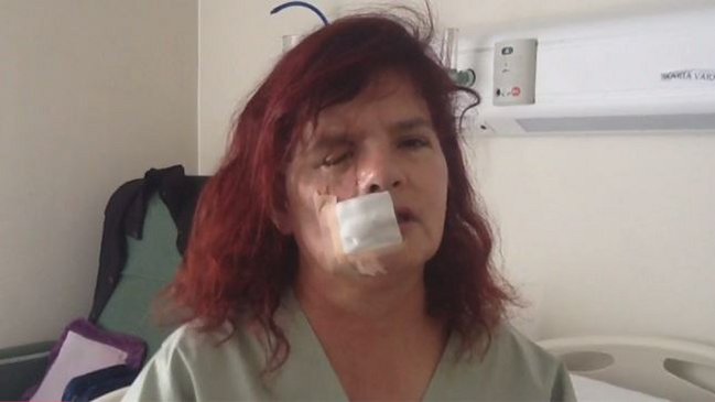 Fiscalizadora del Transantiago empujada por evasor: Se desquitó conmigo porque soy mujer