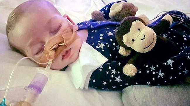 Falleció el bebé británico Charlie Gard tras una larga batalla judicial