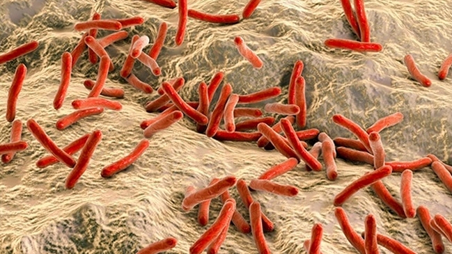 Infectólogo: La lepra es una enfermedad muy poco transmisible