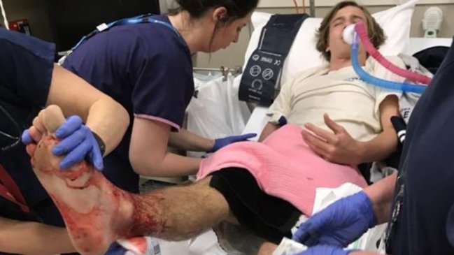 Desconocidas criaturas marinas atacaron a un joven en Australia