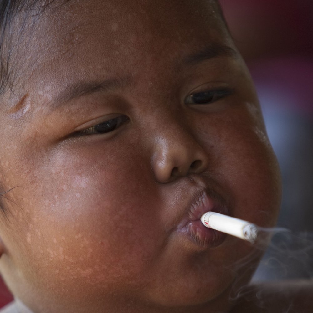 Así está el bebé que se hizo famoso por fumar