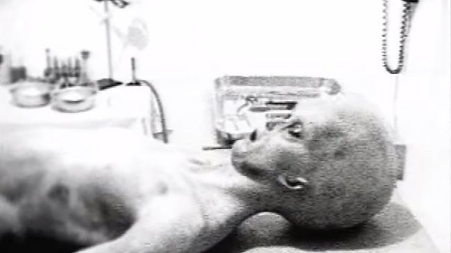 Revelan detalles de la falsa y famosa autopsia de un alien