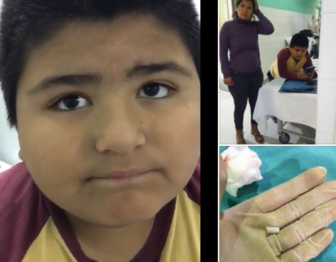 Niño que se tragó un pito generó divertidas reacciones en Twitter