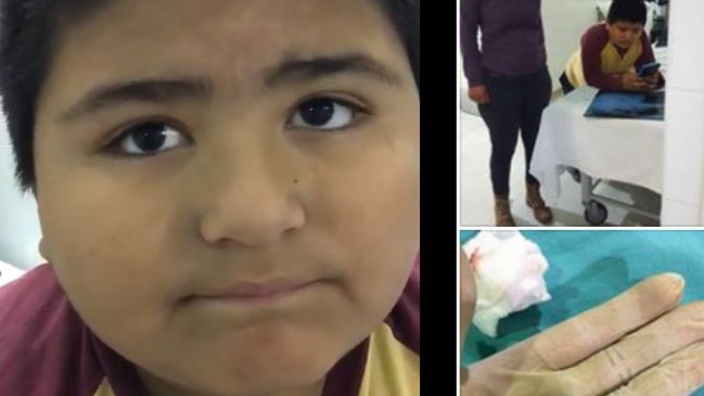 Niño que se tragó un pito generó divertidas reacciones en Twitter