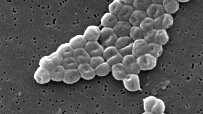 Detectan peligrosa bacteria en UCI de Neonatología del Hospital de Concepción