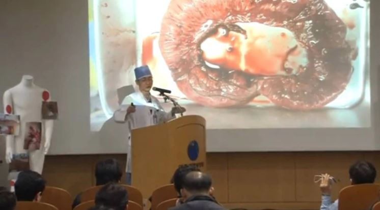 Encuentran lombrices en cuerpo de soldado norcoreano que desertó