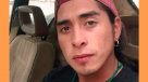 Argentina: Mapuche recibió bala de arma similar a la que usa la Policía