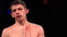 Boxeador casi pierde su oreja durante combate