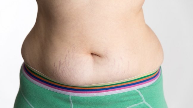 Descubrieron feto muerto en el estómago de un niño de 15 años