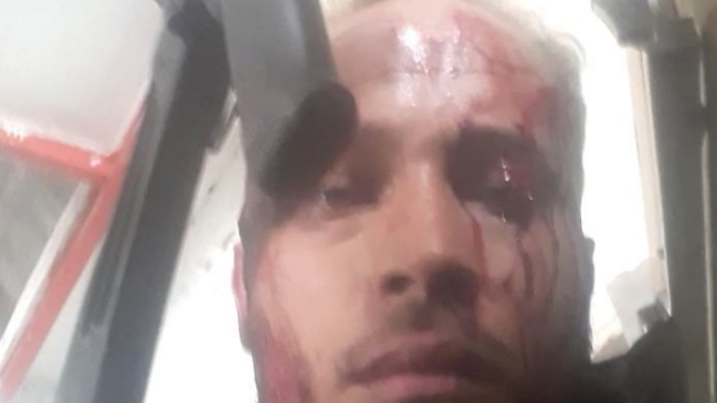 Guardia bolivariana mantiene acorralado al policía que se rebeló