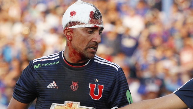 ¿Cuál es el mayor papelón deportivo que recuerdas?