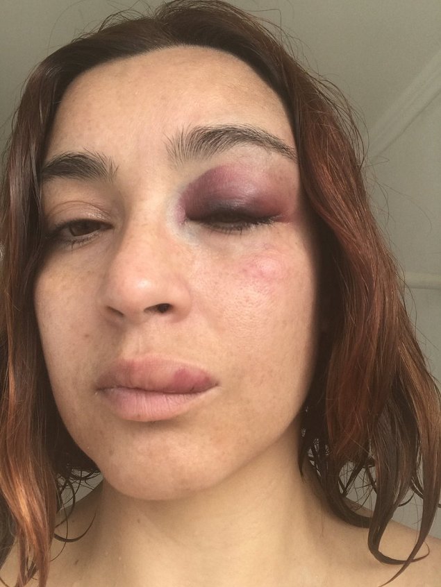 Imagen foto_00000017