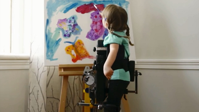 Tratamiento único para frenar progresión de la Atrofia Muscular Espinal llegó a Chile