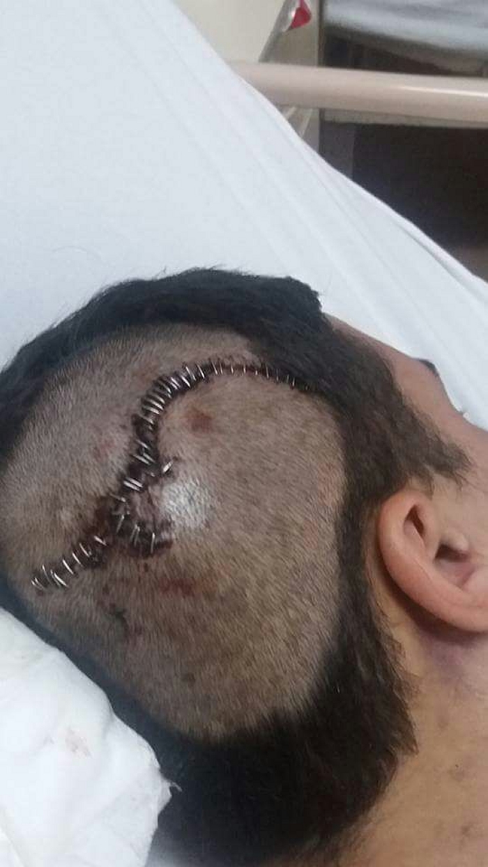 Imagen foto_00000001