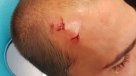 Hinchas invadieron práctica y agredieron a jugadores y DT de Sporting de Lisboa
