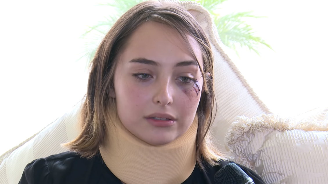 Actriz mexicana enfrentó a su agresor sexual y este la golpeó en el rostro