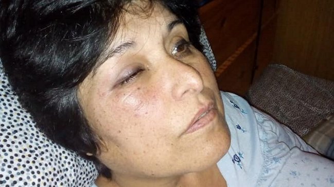 Colegio de Profesores pide cárcel por golpiza a maestra