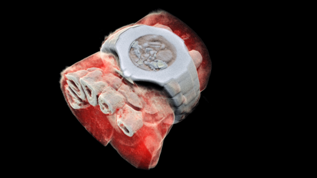  Tecnología CERN permite obtener radiografía en 3D y a color  
