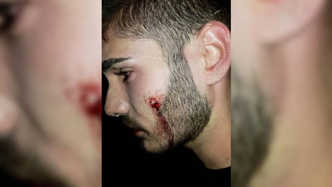 Denuncian agresión a joven gay por besar a su pololo en una discoteca